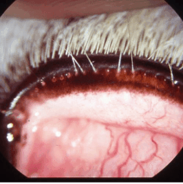 {{brizy_dc_image_alt imageSrc=